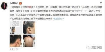 小美弟弟爆料了吗视频在线观看,揭秘幕后真相 第3张 小美弟弟爆料了吗视频在线观看,揭秘幕后真相 第3张